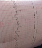 doppler ultrasound reading printouts coming out of a machine